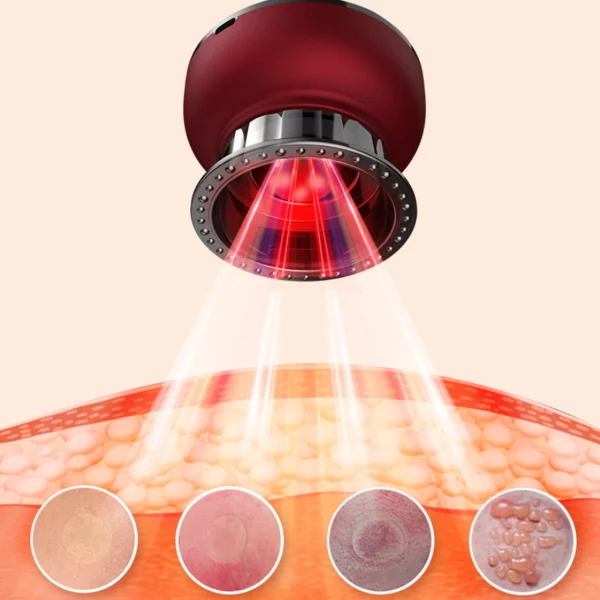 Electric Cupping massage Devices Gua Sha Suction Cups Vacuum Negative Pressure Body Scraping Cupping Dropship