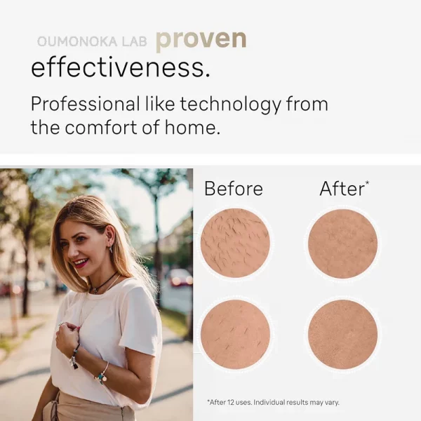 S82dc828ae2e24006a49cdd41ebe8c12aW-1.webp IPL Hair Removal Device 999999 Flashes Painless Laser Epilator for Women Permanent Hair Removal Home Use Body Bikini Face