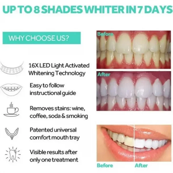 Sd811d4bc7b61413bb822af027f097071m.webp Tooth Whitening Accelerator Lamp Oral Care Tray Portable Whitening Enhancement Lamp Gel Cold Light Tooth Yellowing Removal